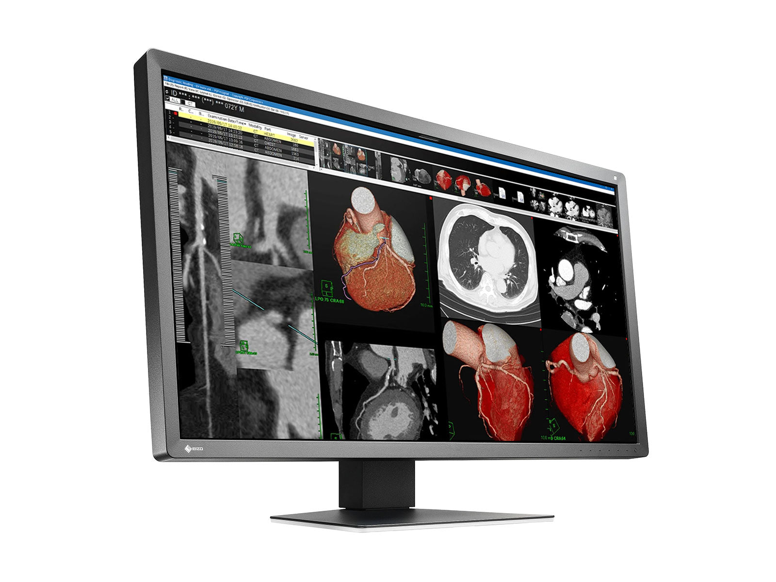 Eizo RadiForce MX317W 8MP 30" Color Clinical Review Display Monitor (MX317W-BK)