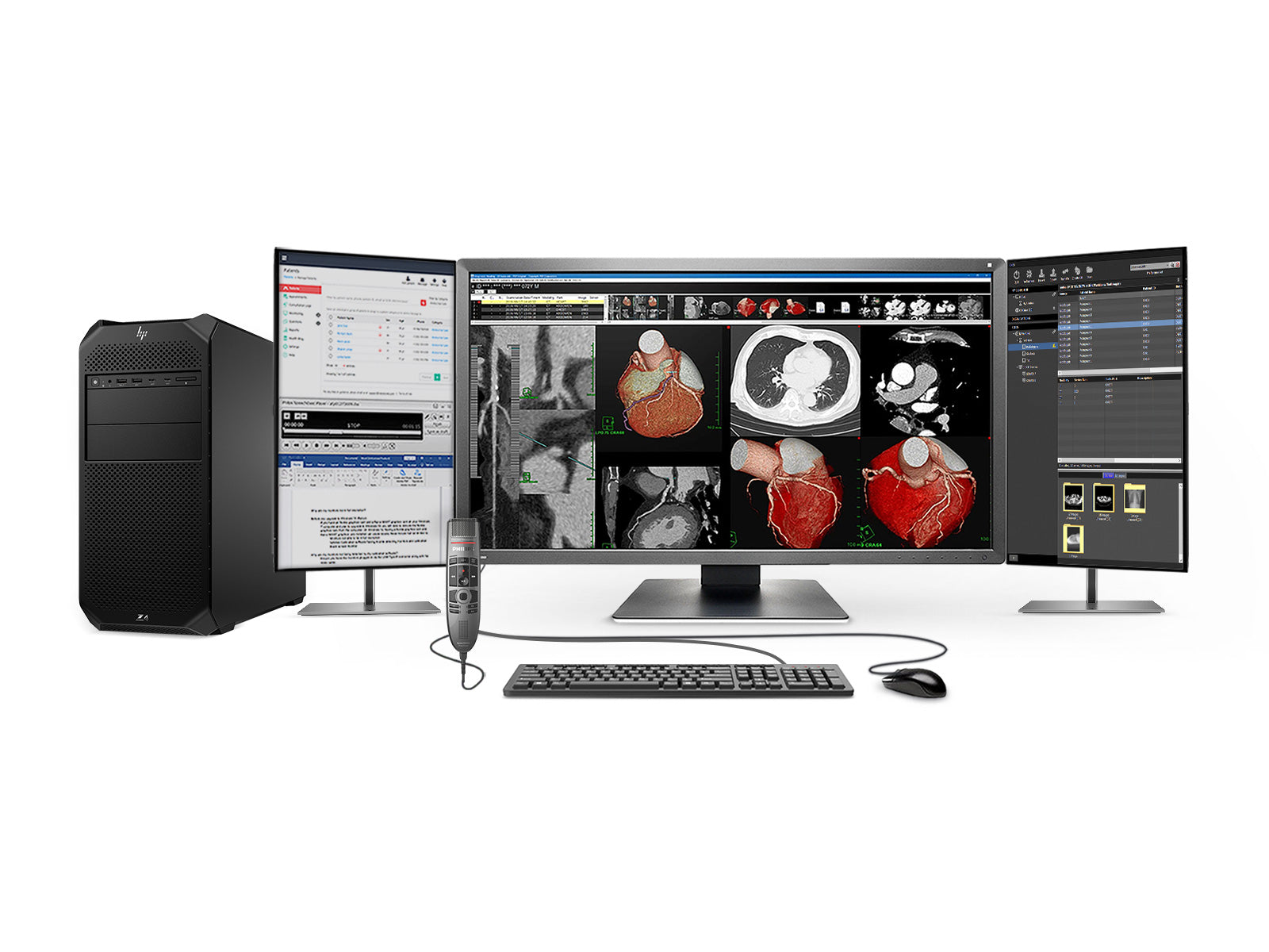 Komplette PACS-Station für allgemeine Radiologie | Eizo 8MP Farbdisplays | HP Z4 G5 Workstation | Diktiermikrofon | Arbeitsvorratsmonitor (MX317WZ4G5)