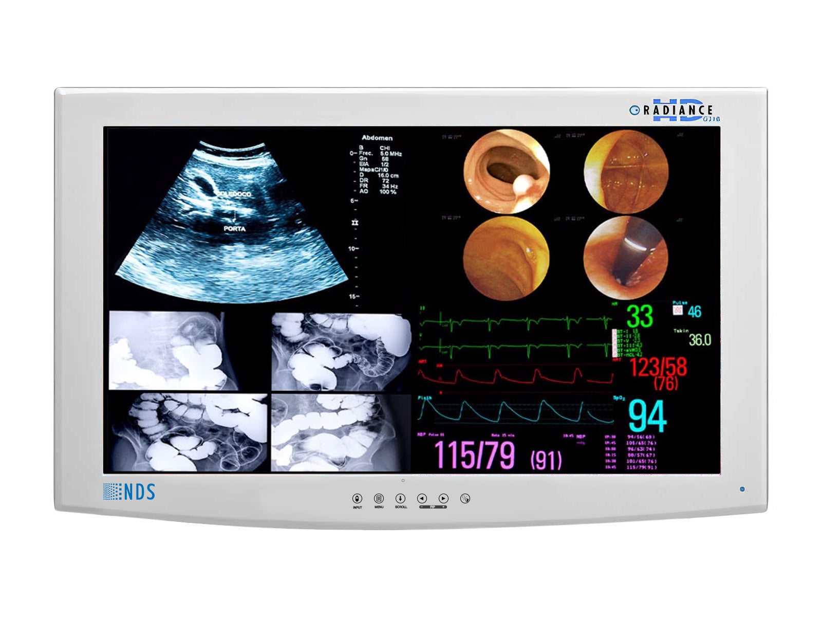NDS Radiance SC-WU24-A1511 24" HD Surgical Display Monitor