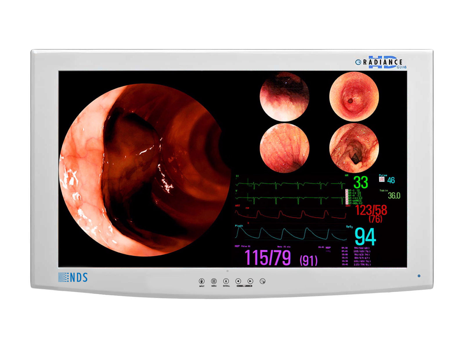 NDS Radiance SC-WU26-A1511 26" HD Surgical Display Monitor