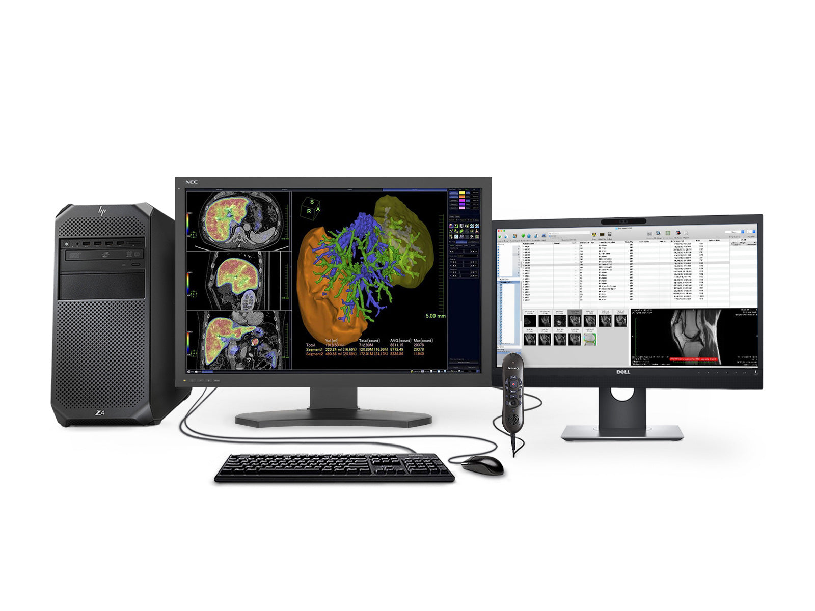 NEC Complete PACS General Radiology Station | HP Workstation