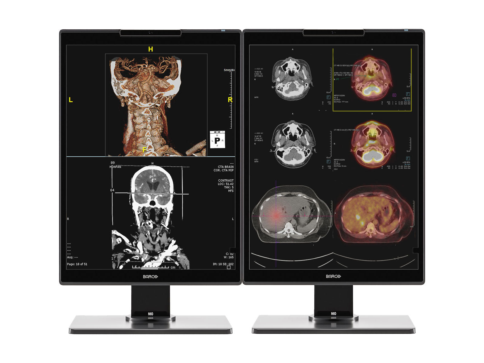 Complete PACS General Radiology Station | Barco 3MP Color LED MDNC-3521 | HP Z4 G5 Workstation | Dictation Mic | Worklist Monitor (3521Z4G5)