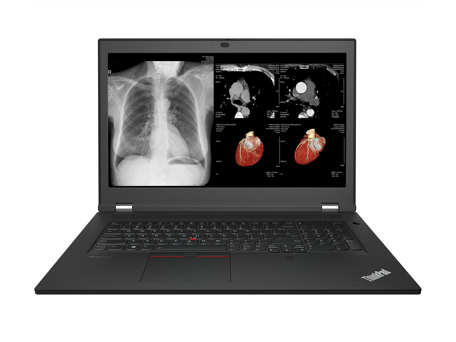 Lenovo ThinkPad P17 G2 Mobile Workstation | Intel Xeon W-11855M | 128GB DDR4 | 1TB SSD | RTX A5000