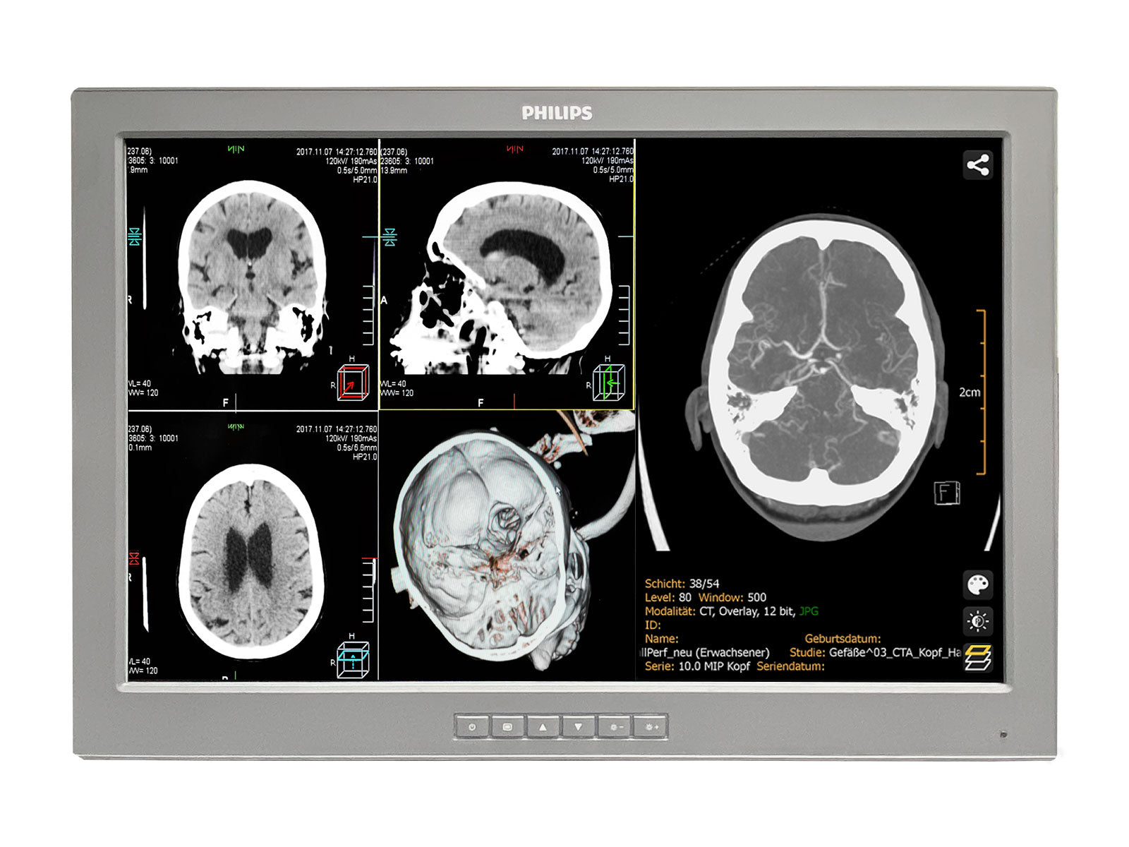 Barco P240-LTv Touchscreen MED24ESB 24" 2MP Philips DICOM Surgical Display Monitor by Fimi Barco (P240-LTv)
