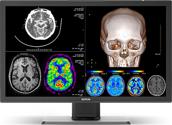 Barco 8MP 4K Diagnostic Monitor
