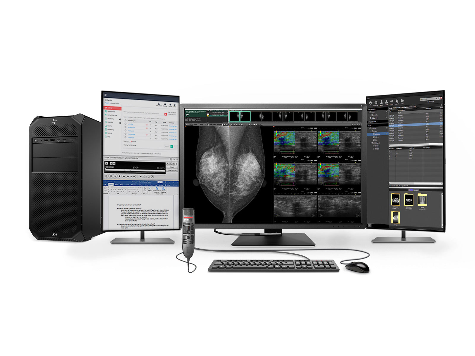 Complete Mammography Reading Station | Eizo 12MP Color Display | Lenovo Workstation | Dictation Mic | Worklist Monitors (RX1270Z4G5)