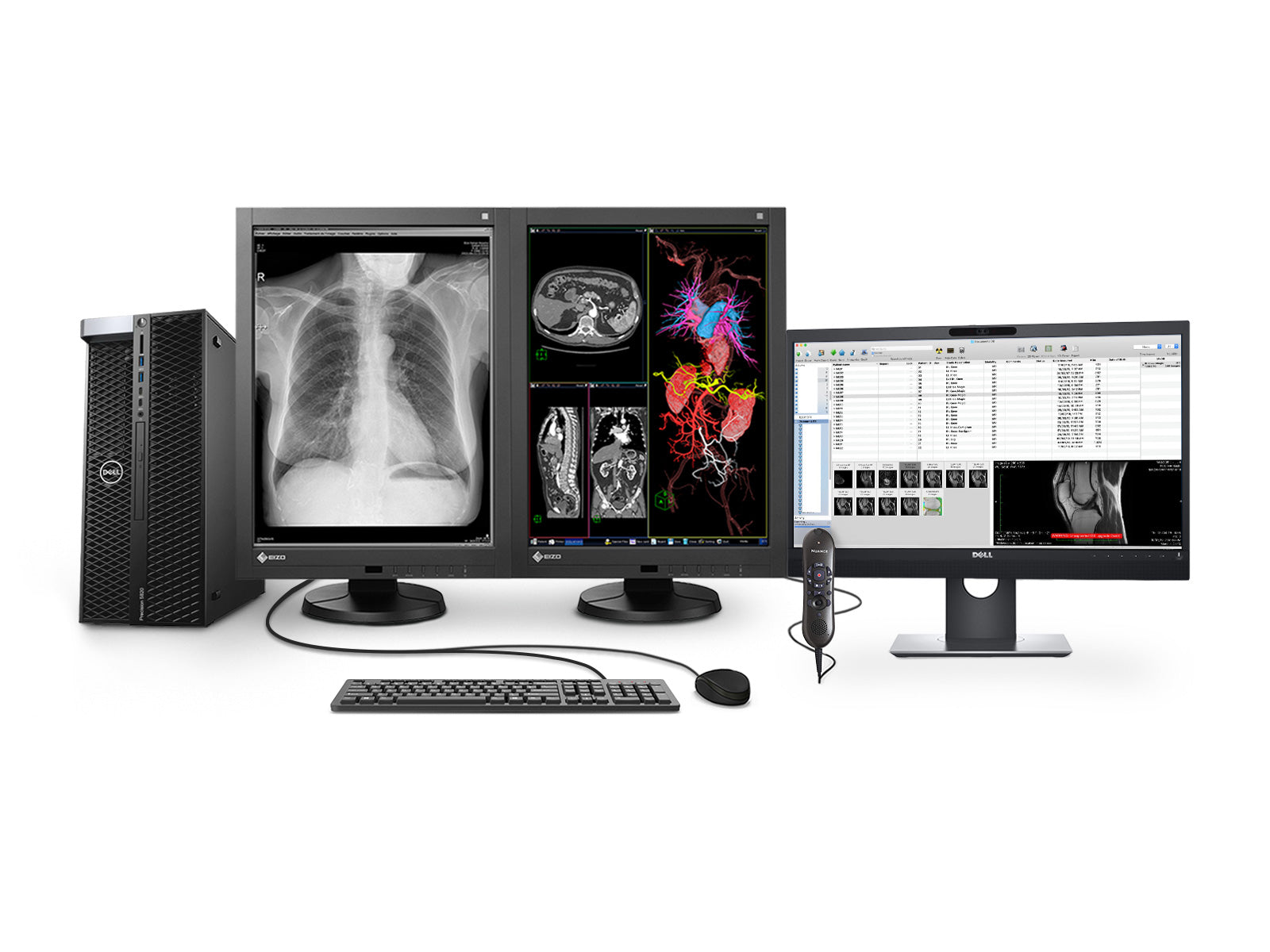 Eizo Complete PACS General Radiology Station | Dell Workstation