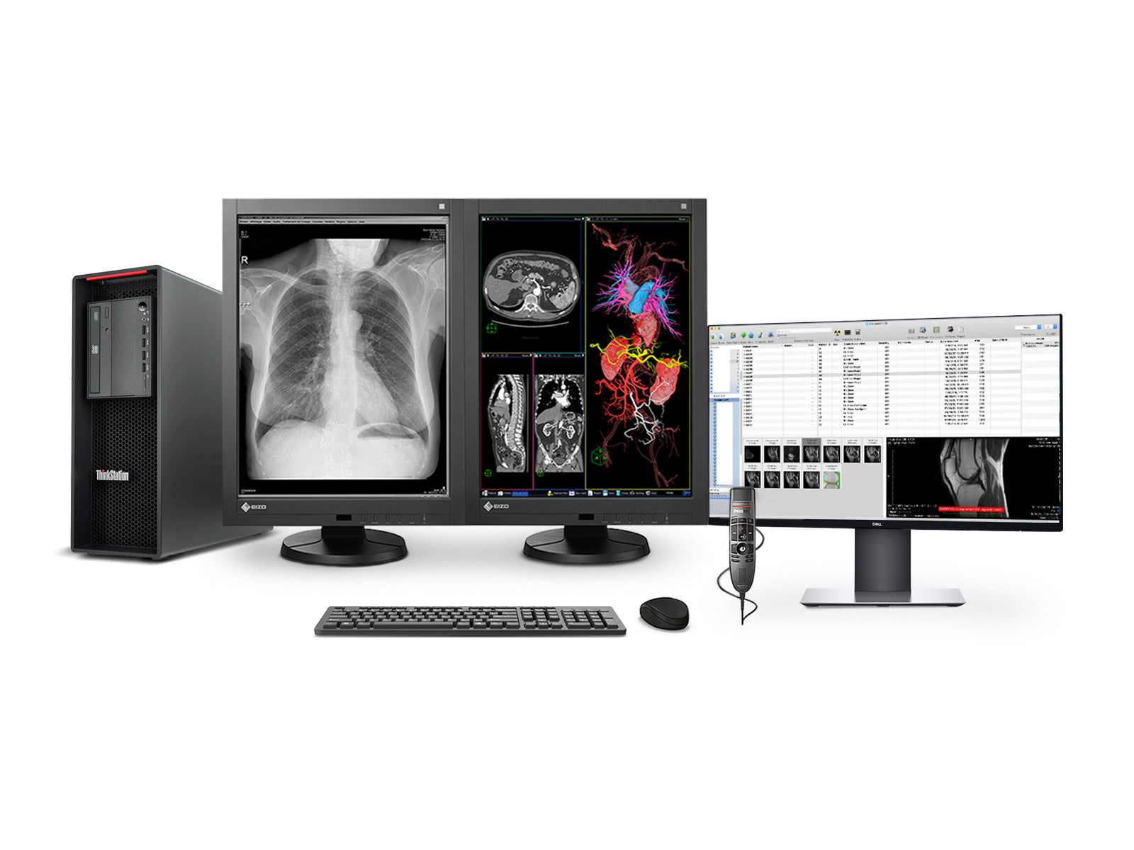 Complete PACS General Radiology Station | Eizo Radiforce RX340 3MP Color LED Displays | Lenovo Workstation | Dictation Mic | Worklist Monitor (RX340Z4R)