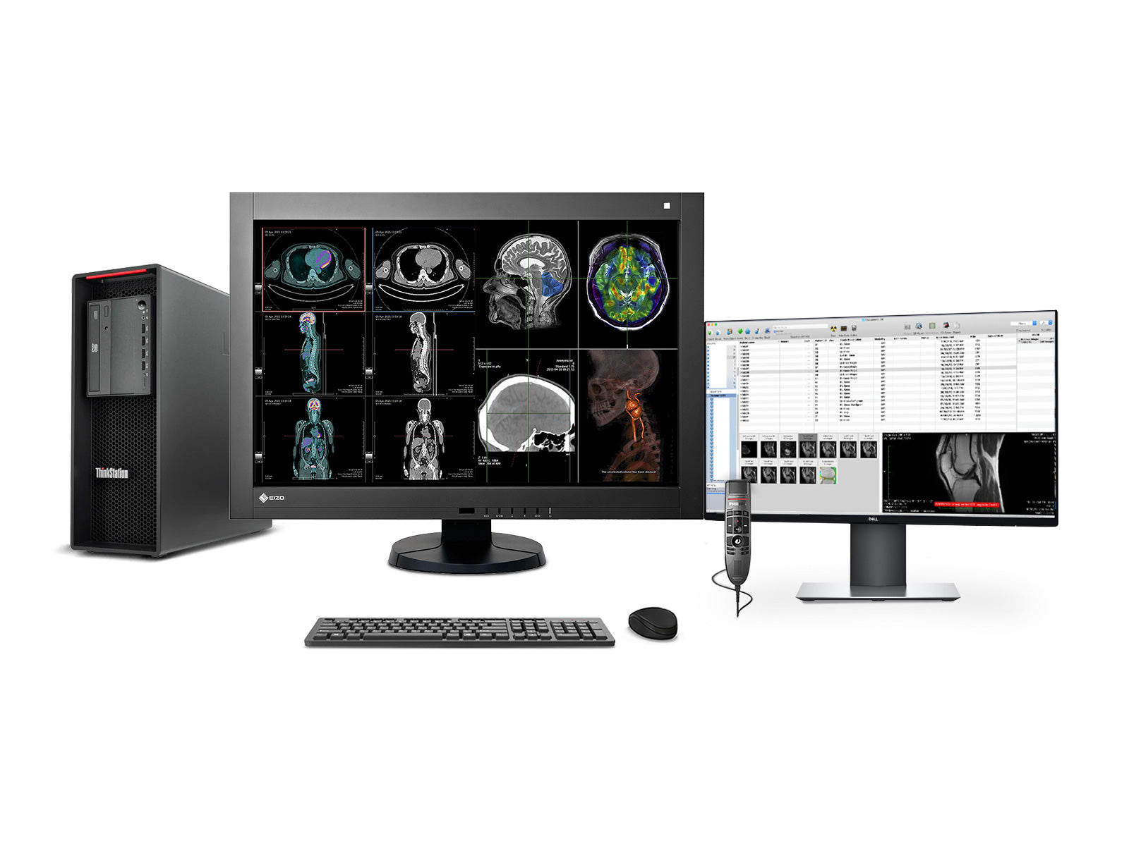 Complete PACS General Radiology Station | Eizo Radiforce RX440 4MP Color LED Displays | Lenovo Workstation | Dictation Mic | Worklist Monitor (RX440Z4R)