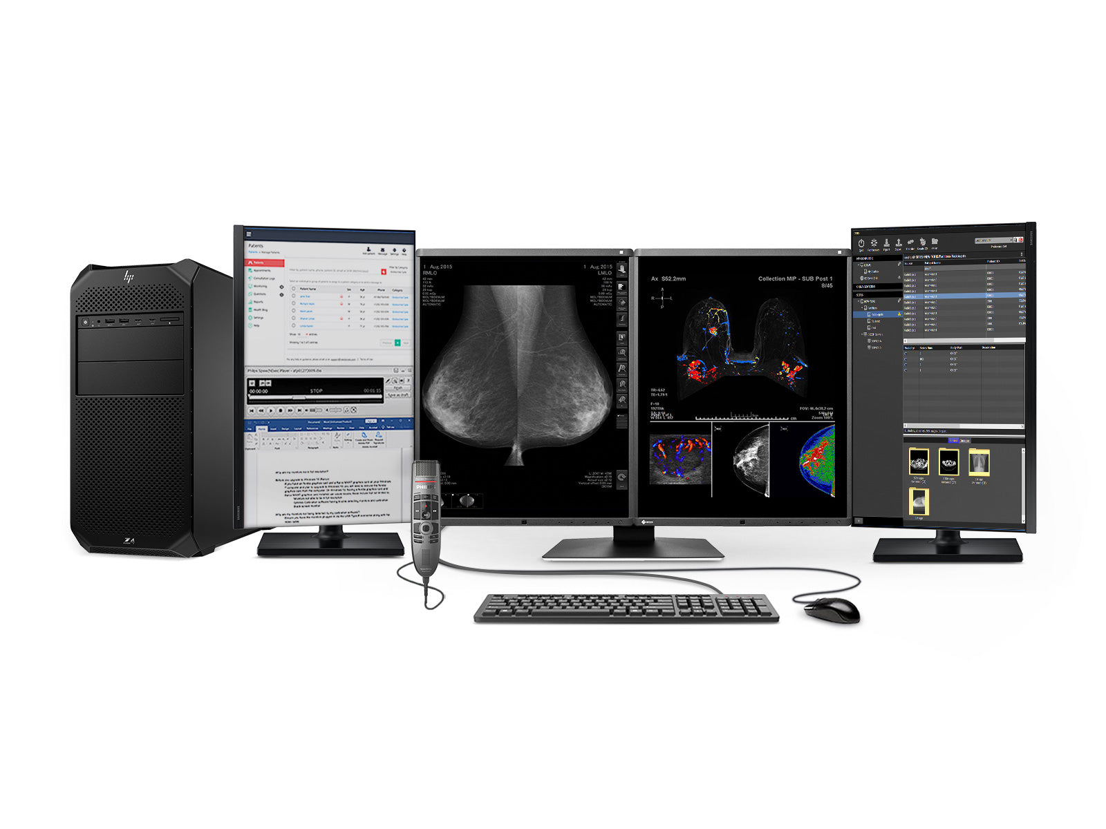 Complete Mammography Reading Station | Eizo 5MP Color Display | Lenovo Workstation | Dictation Mic | Worklist Monitors (RX560Z4G5)