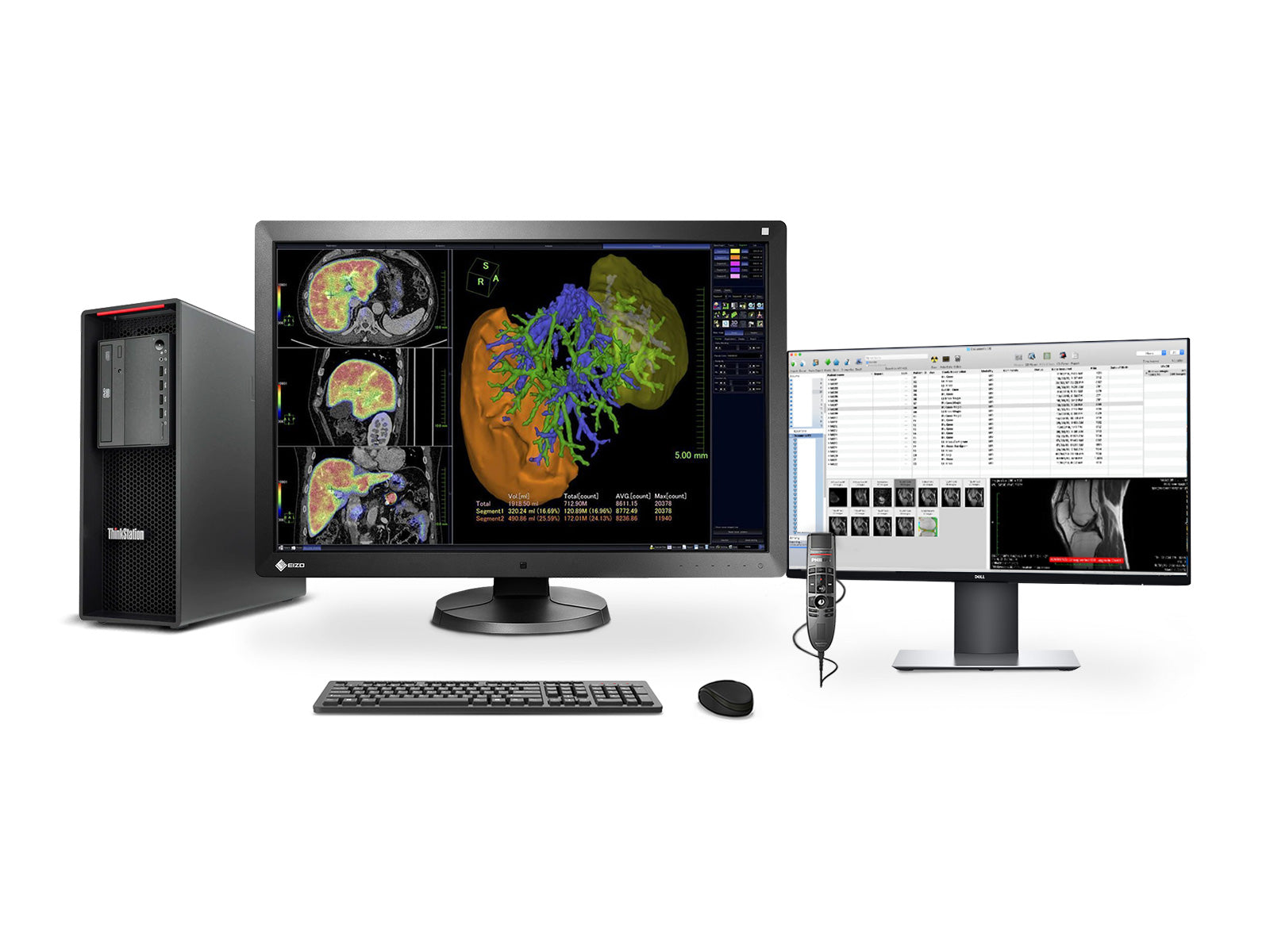 Complete PACS General Radiology Station | Eizo Radiforce RX650 6MP Color LED Display | Lenovo Workstation | Dictation Mic | Worklist Monitor (RX650Z4R)
