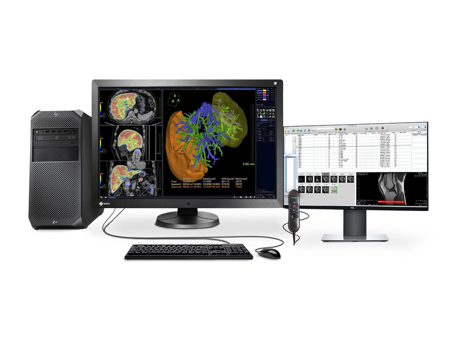 Complete PACS General Radiology Station | Eizo 6MP | HP Workstation