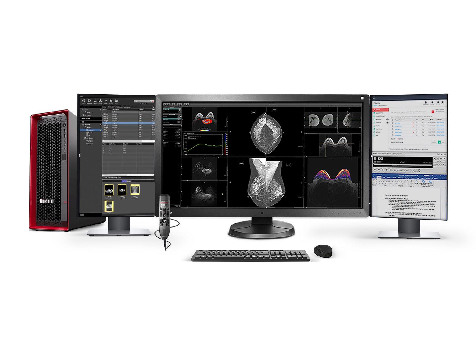 Complete PACS Mammography Reading Station | Eizo Radiforce RX850 8MP Color mammography Monitor | Lenovo Workstation | Dictation Mic | Worklist Monitors (RX850P5)