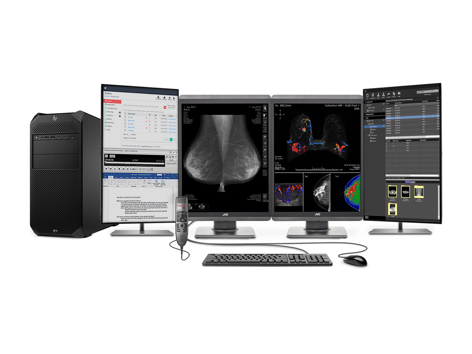 Complete Mammography Reading Station | JVC Display | Lenovo Workstation