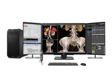 Completa la stazione di radiologia generale PACS | JVC CL-S600 6MP Display a colori | HP Z4 G5 Stazione di lavoro | Microfono di dettatura | Monitor della lista di lavoro (S600Z4G5) 