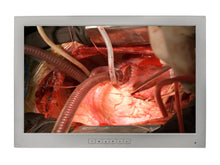 Barco SN240S1 MED24ESH 24" 2MP Philips DICOM Surgical Display Monitor by Fimi Barco (SN240S1)