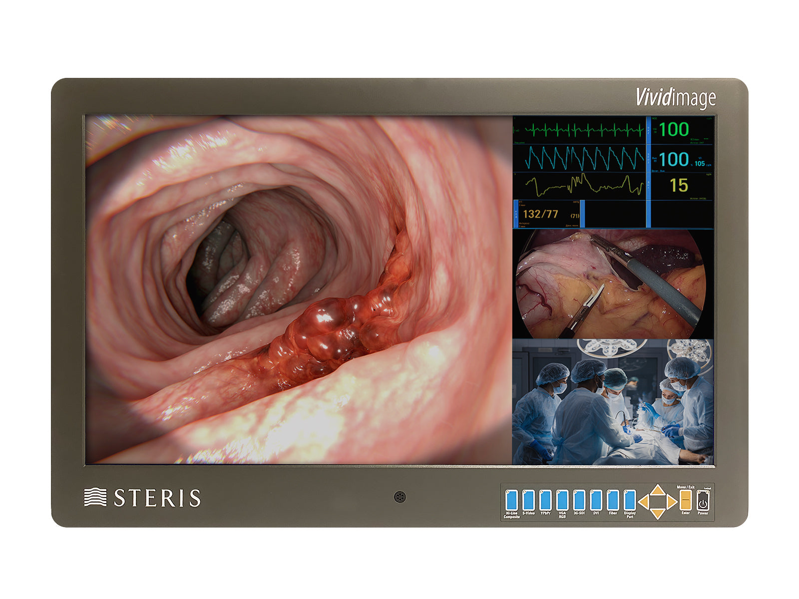 Steris Vividimage STERIS-27-HDD-R 27" Color Surgical Display Monitor (RLM27HDNPWR)