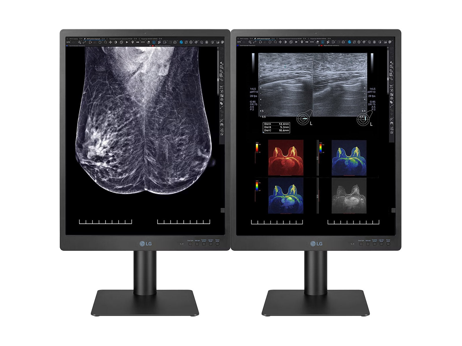 Complete Mammography Reading Station | LG 5MP 21" Color | HP Z2 Mini G9 Workstation | Dictation Mic | Worklist Monitors (21HQ613DZ2MNG9)