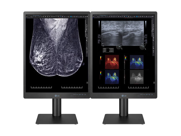 Complete Mammography Reading Station | LG 5MP 21