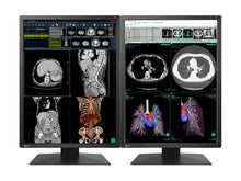 Eizo RadiForce RX270 2MP 21" Cor LED Monitor de Exibição de Radiologia de Diagnóstico Médico (RX270-BK)