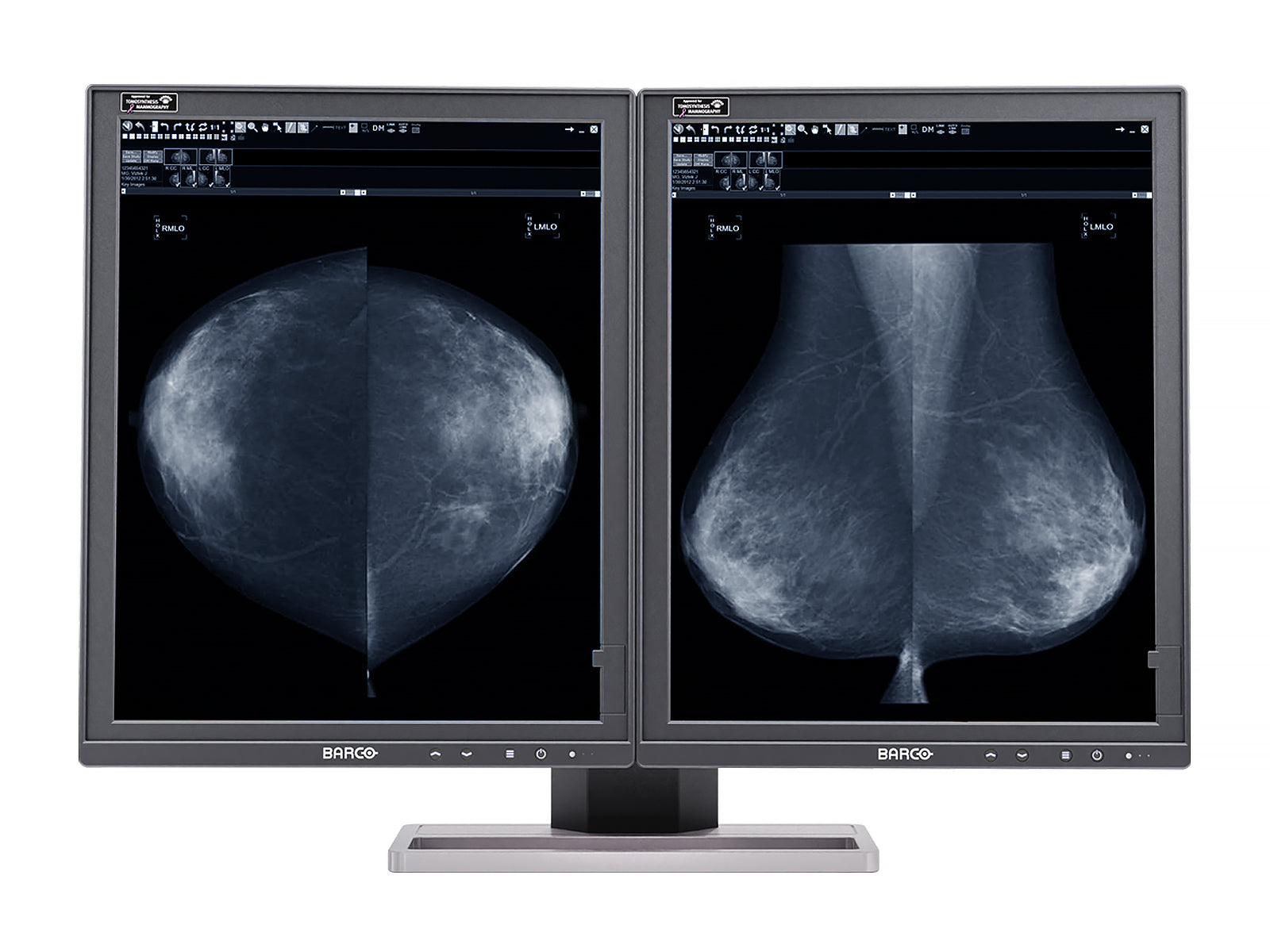 Complete Mammography Reading Station | Barco 5MP Grayscale LED Monitor | HP Workstation | Dictation Mic | Worklist Monitors (5221Z4)