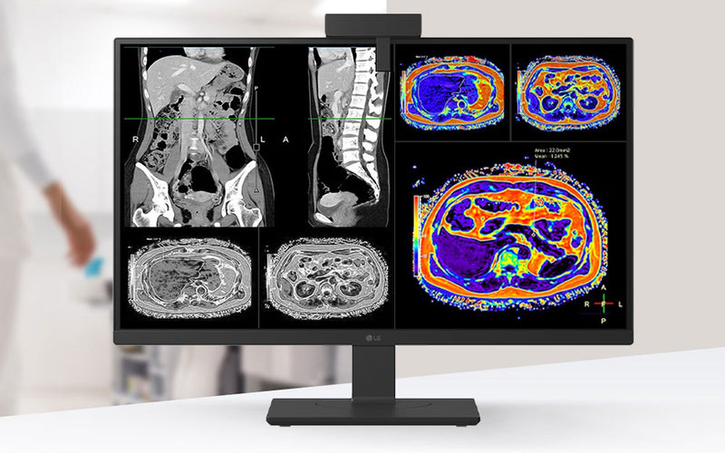 Precision and Efficiency Redefined: The LG 27HS713C 8MP Clinical Review Monitor