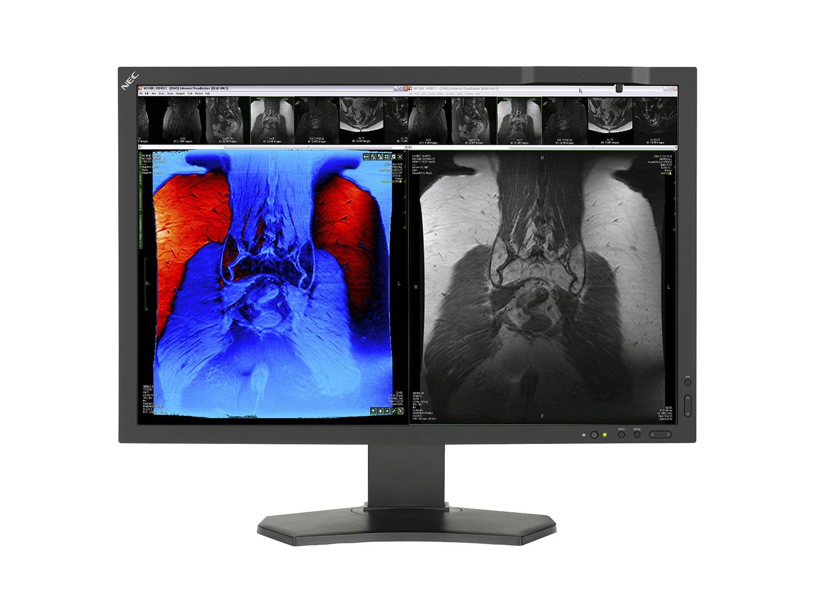 NEC MultiSync MD242C2 2.3MP 24" Color LCD Clinical Review Display Monitor (MD242C2)