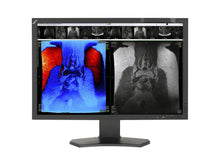 NEC Multisync MD242C2 2.3MP Monitor display clinico LCD da 24 "Color (MD242C2)