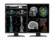 Eizo RadiForce RX370 3MP A cor de 21 polegadas CONDUZIU a radiologia geral exposição de CAP diagnóstica (RX370)