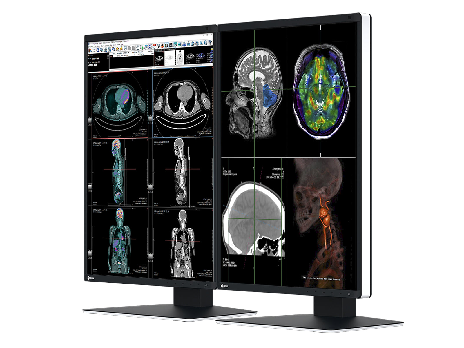 Eizo RadiForce RX370 3MP 21" Color LED General Radiology Diagnostic PACS Display (RX370)