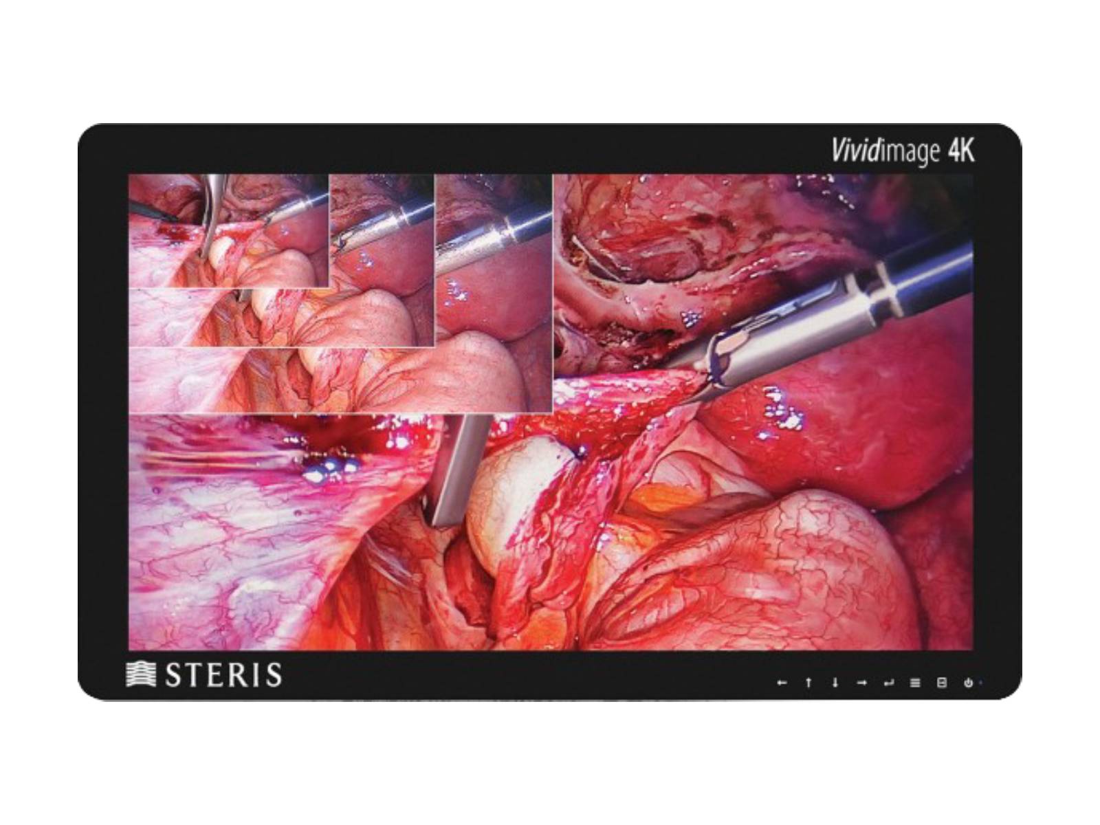 Steris Vividimage RLM314KC 31" 8MP 4K Color LED Surgical Display Monitor (STERIS-31-4K-R)