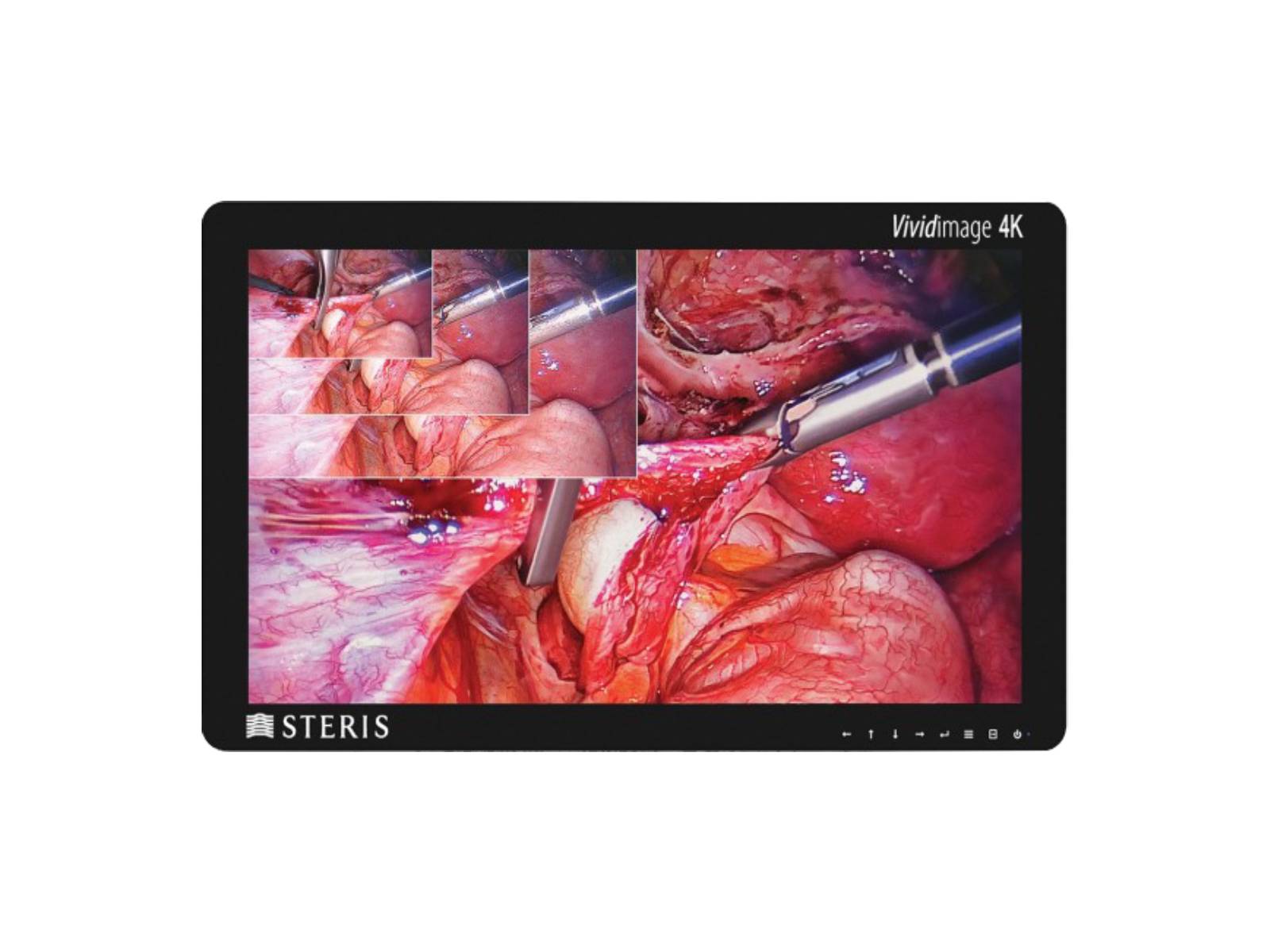 شاشة عرض جراحية ملونة Steris Vividimage STERIS-27-HDD-R مقاس 27 بوصة (RLM27HDNPWR)