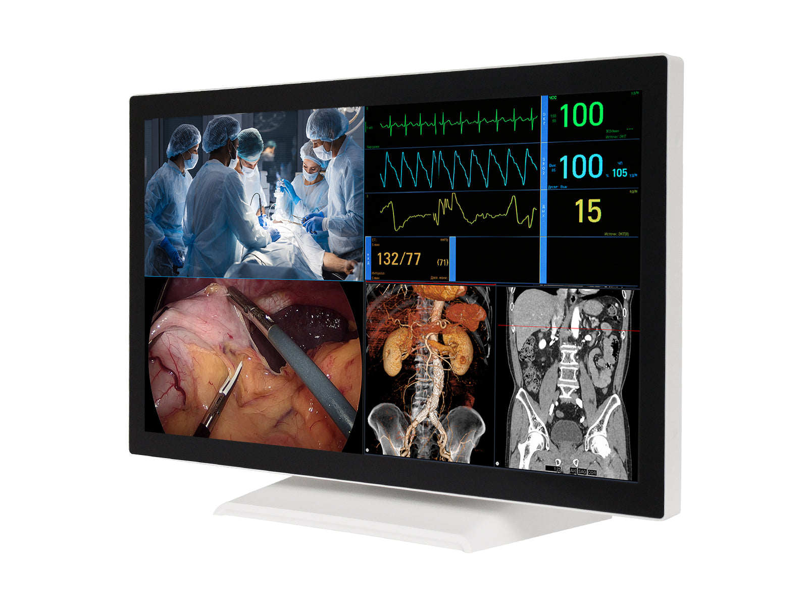 Barco AMM 215WTTP 21.5” Full HD Touchscreen Color Clinical Review Display Monitor (215ETTWZA)