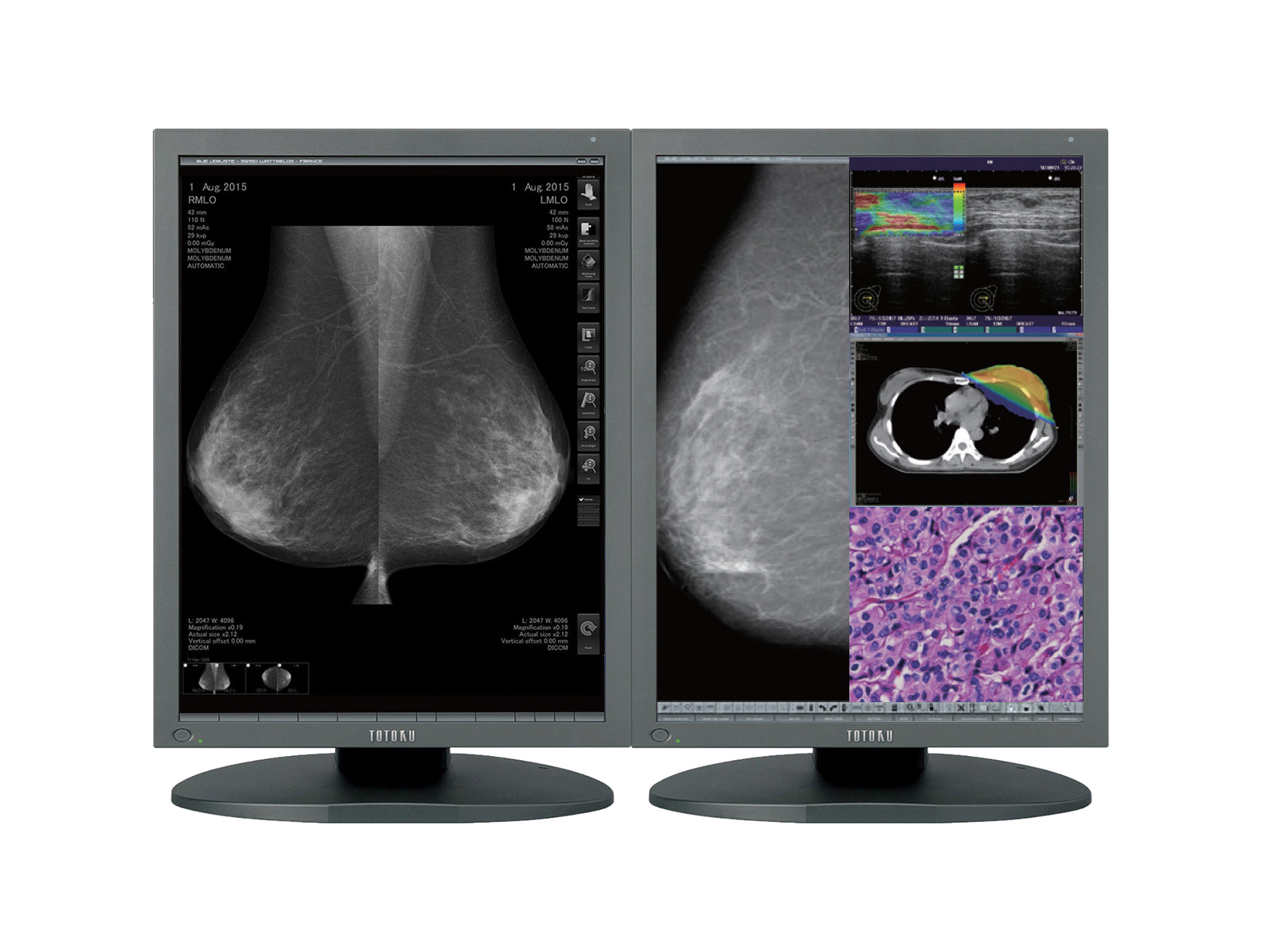 JVC Totoku CCL550i2 5MP 21" Color LED Mammo 3D-DBT Breast Imaging Display (CCL550i2) Monitors.com 