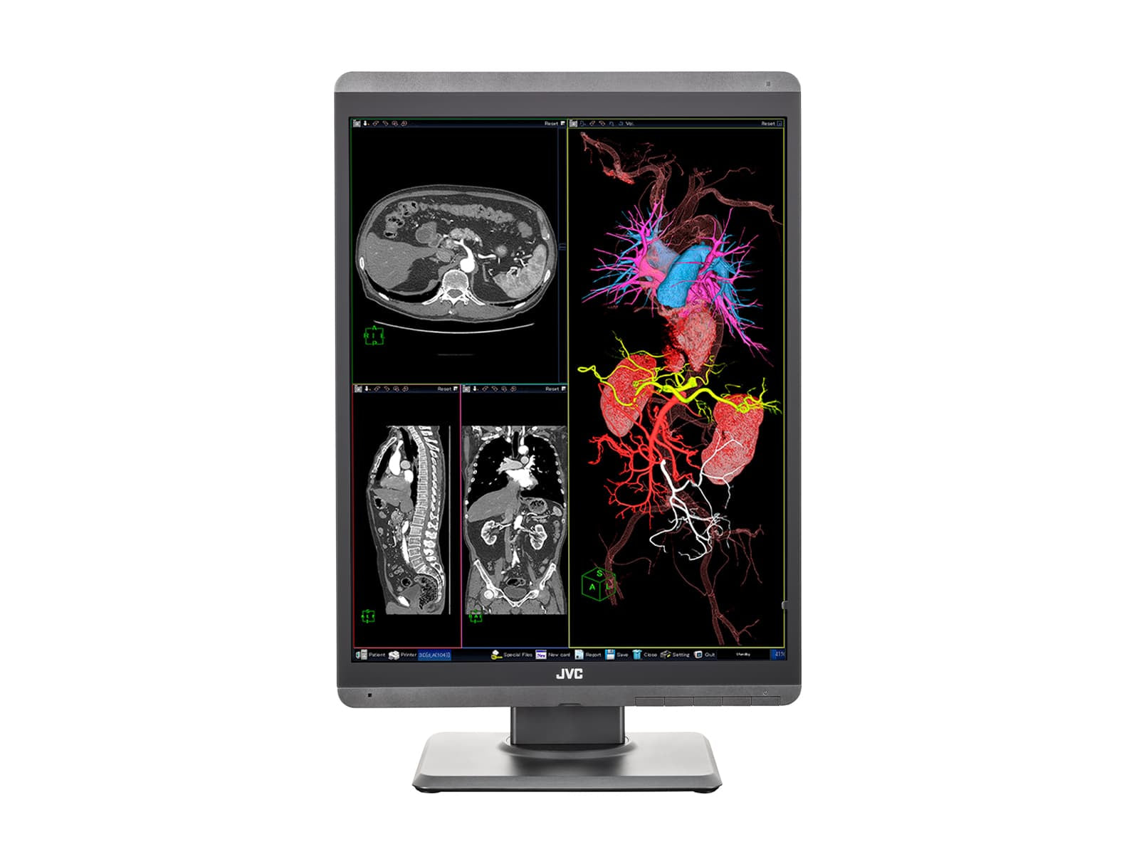JVC Totoku CL-S300 3MP 21" Color LED General Radiology Diagnostic Display Monitors (CL-S300) 