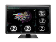 Eizo RadiForce RX660 6MP A cor de 30 polegadas CONDUZIU a exposição de CAP de radiologia geral (RX660-AR)