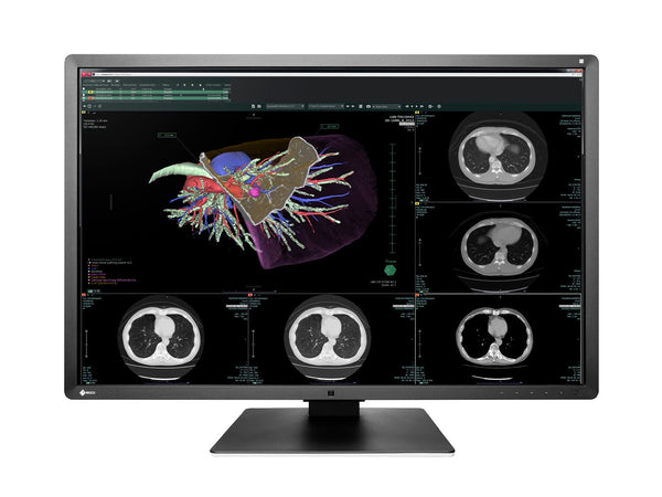 Eizo RadiForce RX660 6MP 30" Color LED General Radiology PACS Display (RX660-AR)