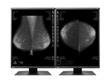 Eizo RadiForce GX560 5MP 21 "LED Escala de Cinza Mamãe 3D-DBT Monitor de Exibição de Imagem de Mama (GX560-MD)