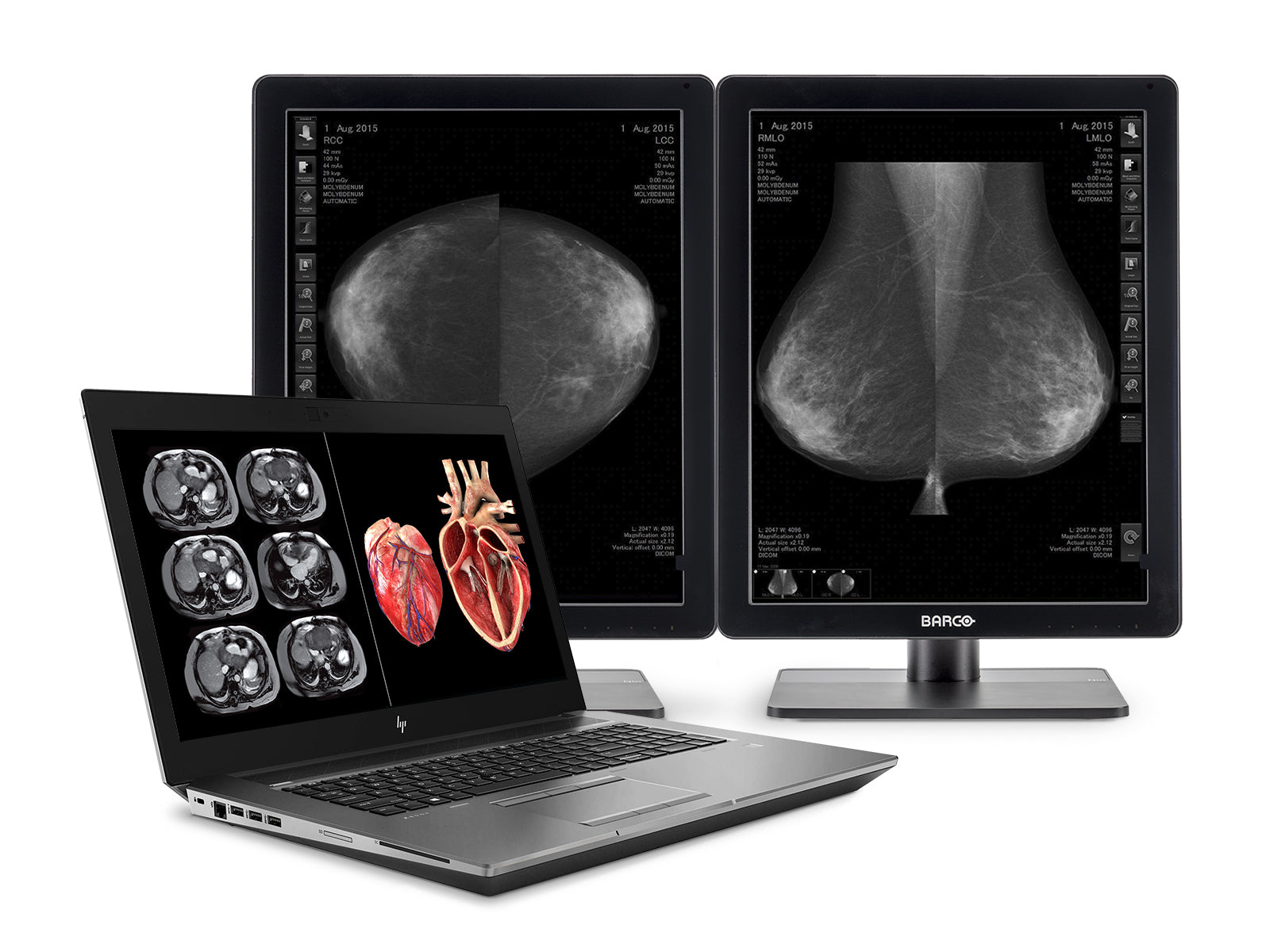 HP Zbook 17 G6 Mobile Rad Workstation | Intel i7-9850H | 64GB DDR4 | 1TB NVMe SSD | Quadro RTX 5000