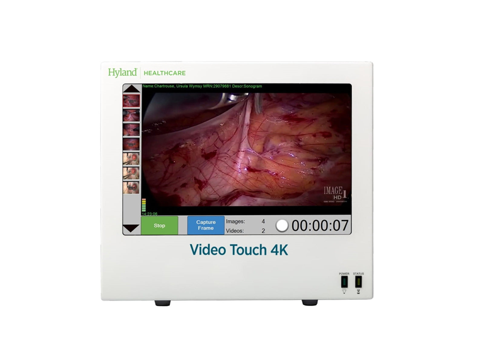 Hyland 4K Touch Medical Video Capture System (PER9472) Monitors.com 