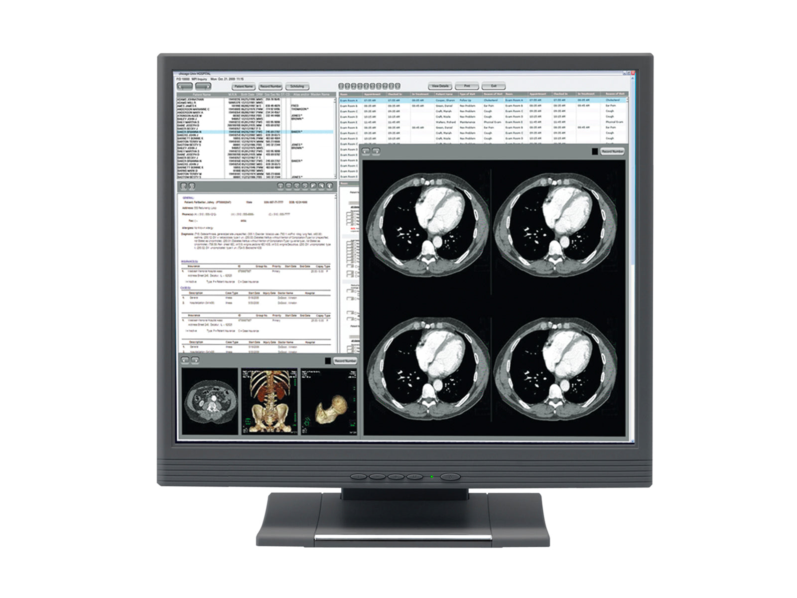 JVC CV932PJ 1.3MP 19" Touchscreen Color Clinical Review Display (CV932PJ) Monitors.com 