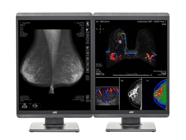 Complete Mammography Reading Station | JVC Totoku CL-S500 5MP Color 3D-DBT Displays | HP Z4 G5 Workstation | Dictation Mic | Worklist Monitors (S500Z4G5)