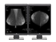 JVC Totoku MS-S500 5MP 21" Mammo 3D-DBT Display per l'imaging del seno a LED in scala di grigi (MS-S500)