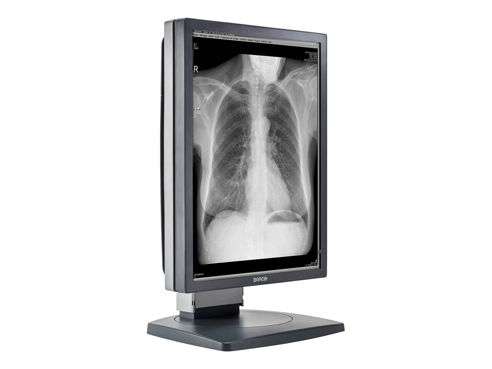 Barco Coronis MDCG-3120 3MP 21" Grayscale General Radiology Diagnostic Display (K9601662) Monitors.com 