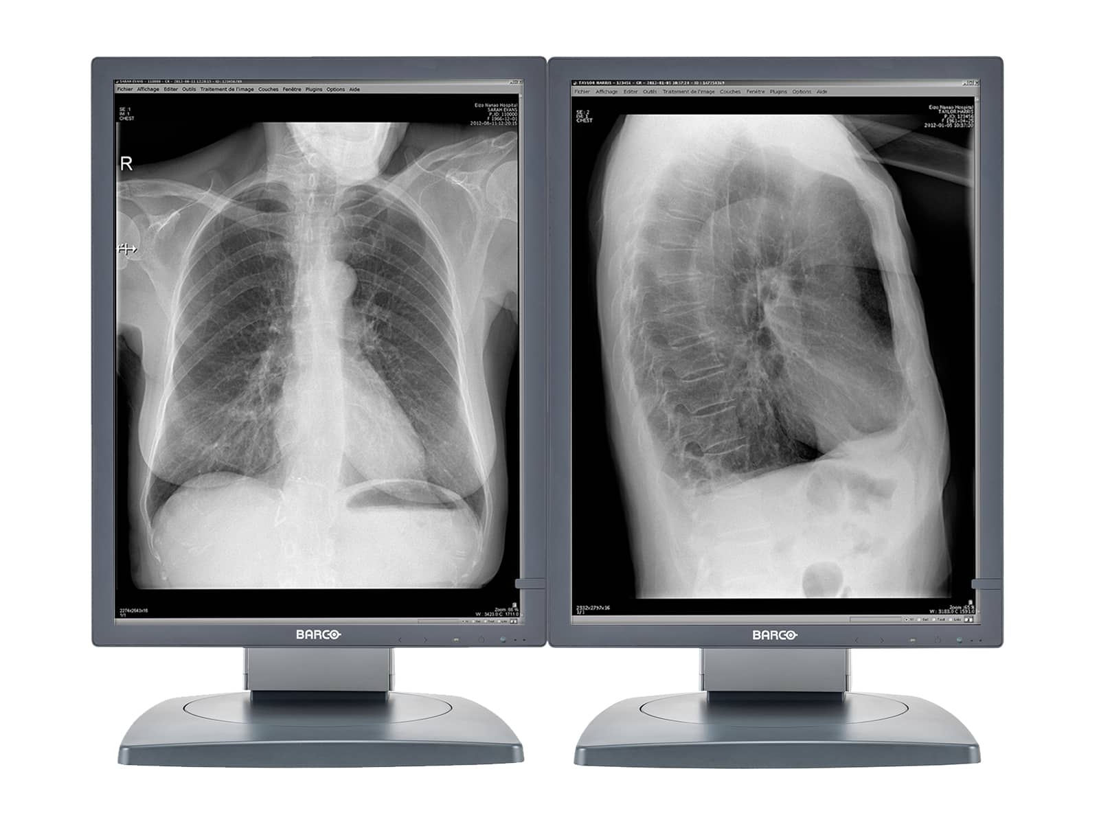 Barco Coronis MDCG-2121 2MP 21" Grayscale Diagnostic Radiology PACS Monitor (K9601659) Monitors.com 