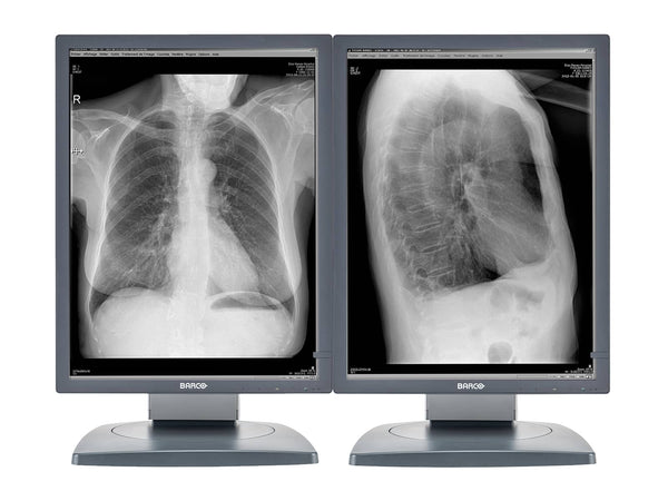 Barco Coronis MDCG-2121 2MP 21" Grayscale Diagnostic Radiology PACS Monitor