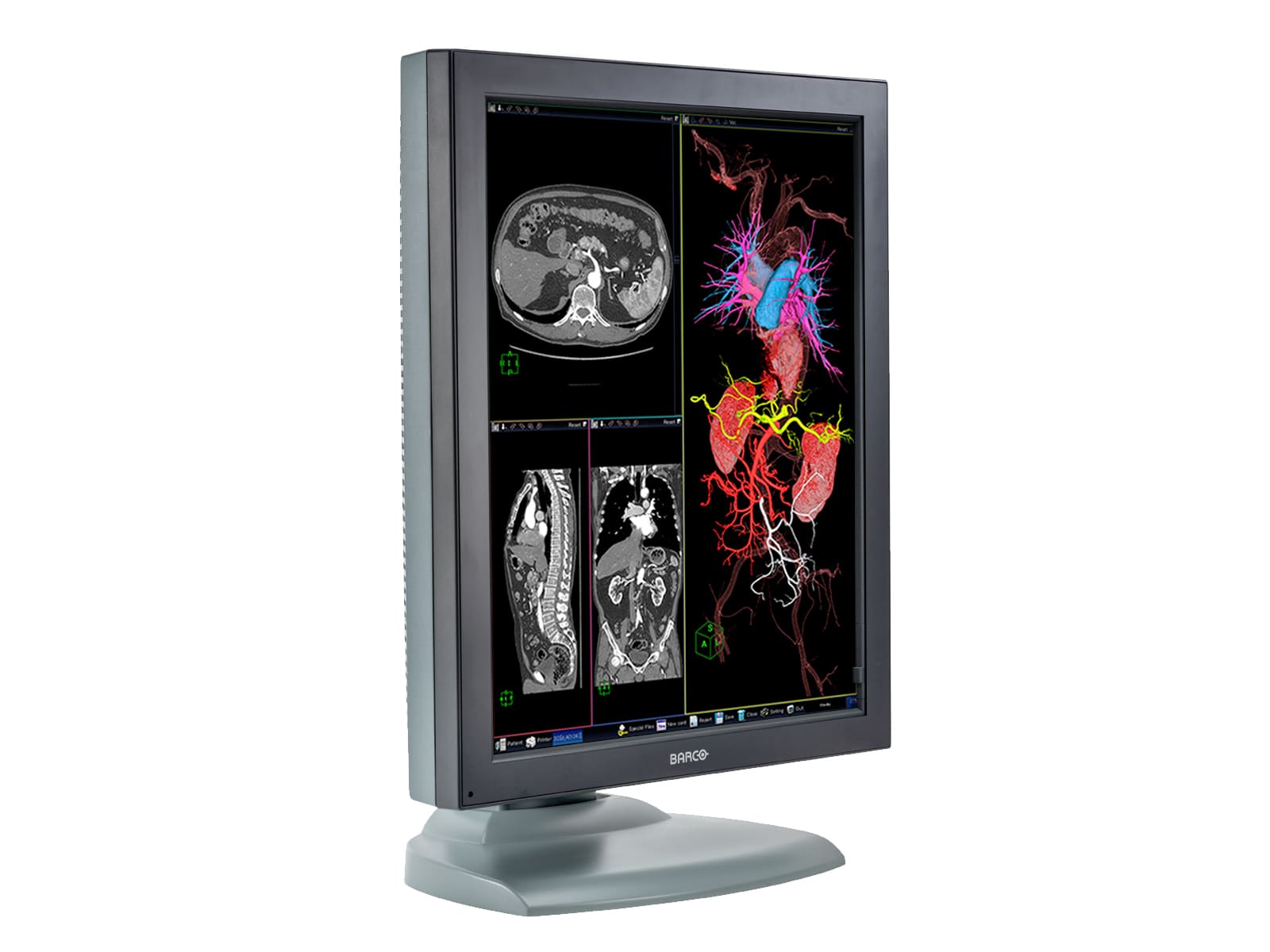 Barco Nio MDNC-3121 HighBright 3MP 21" Color Medical Diagnostic Radiology Monitor