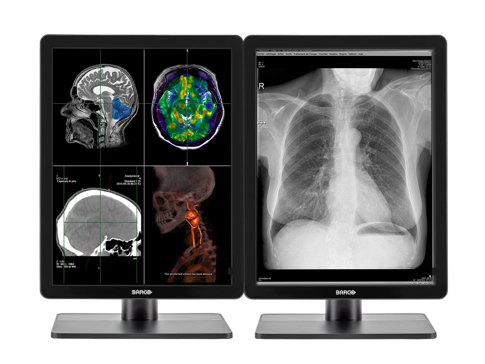 Complete PACS General Radiology Station | Barco Nio MDNC-3321 3MP Color LED Displays | HP Workstation | Dictation Mic | Worklist Monitor (3321Z4R)