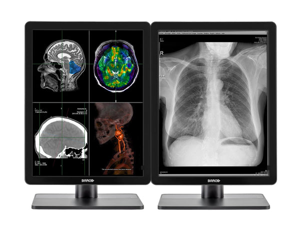 Complete PACS General Radiology Station | Barco Nio MDNC-3321 3MP Color LED Displays | HP Workstation | Dictation Mic | Worklist Monitor (3321Z4R)