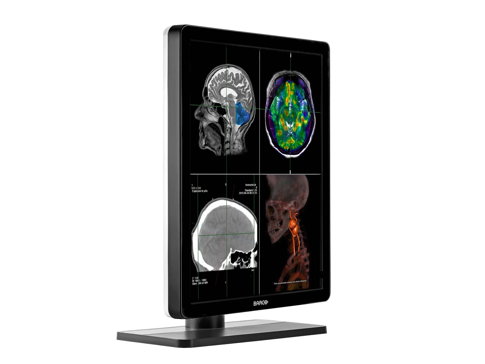 Barco Nio MDNC-3321 3MP 21" LED General Radiology Diagnostic PACS Display (K9300323A) Monitors.com 